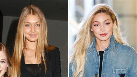 gigi hadid plastic surgery|Gigi Hadid Addresses Plastic Surgery Rumors After Years